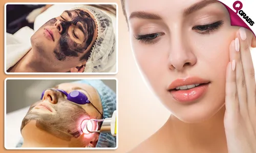 Carbon Laser Treatment!